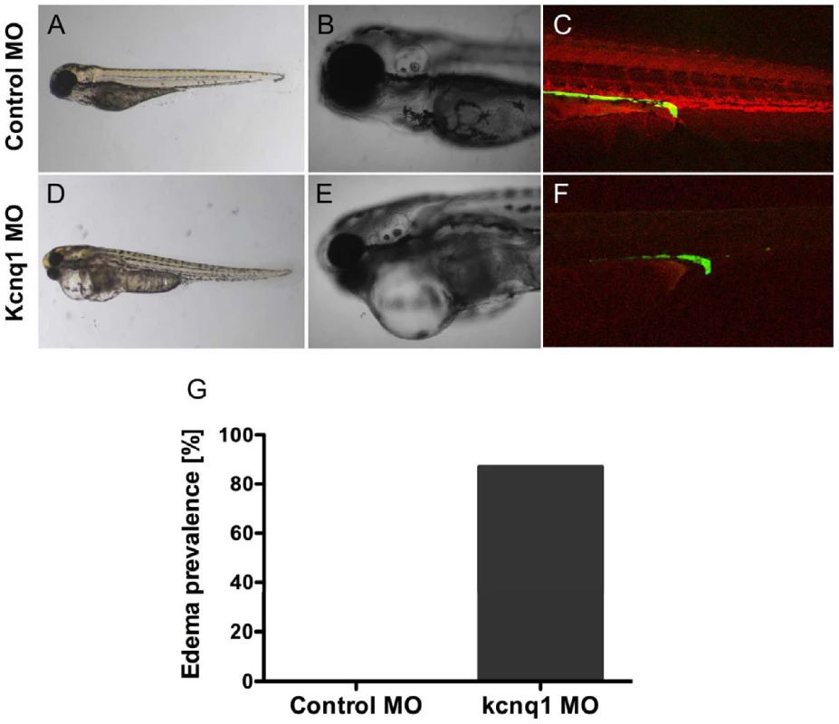 <i>Tg(cdh17:GFP)</i> embryos were injected with 200 uM control or kcnq1 morpholino (MO) at the 1-cell stage.