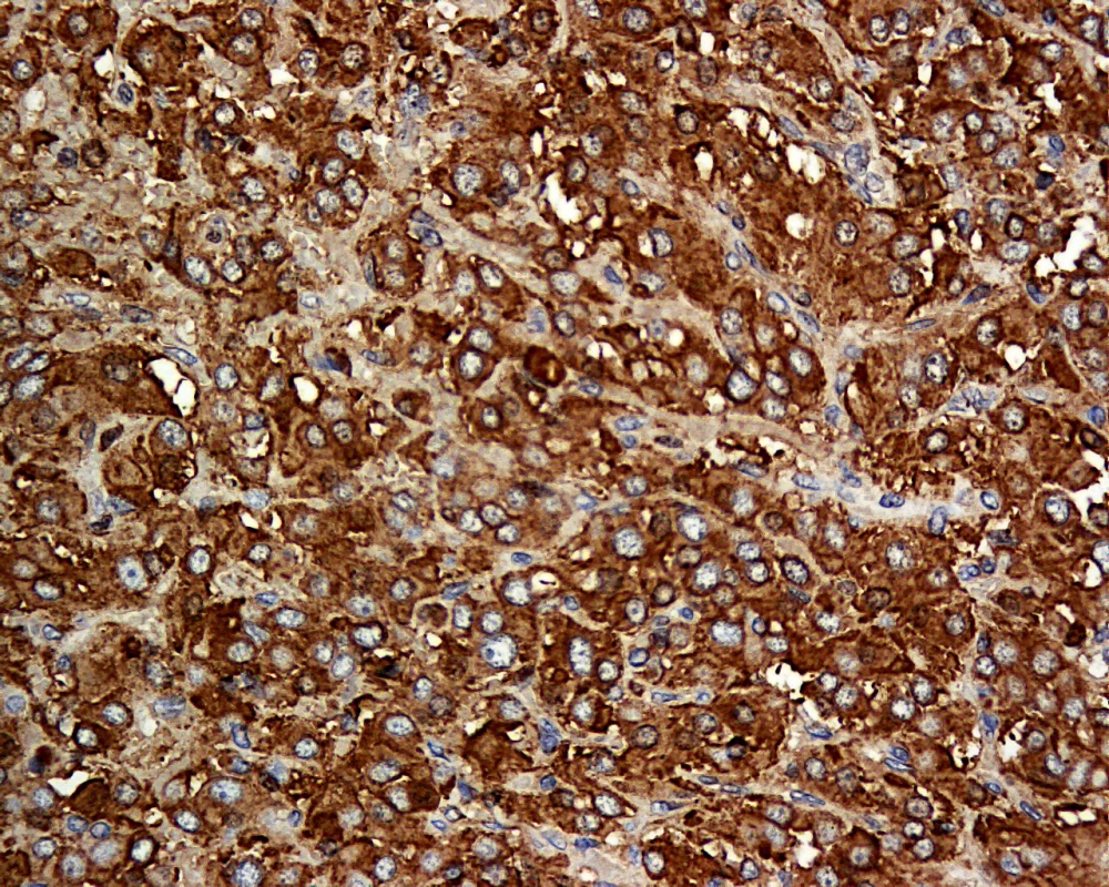 Histological Section of the Resected Tumour