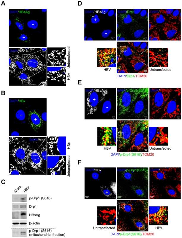 HBV/HBx promotes mitochondrial fission via Drp1 stimulation and activation.