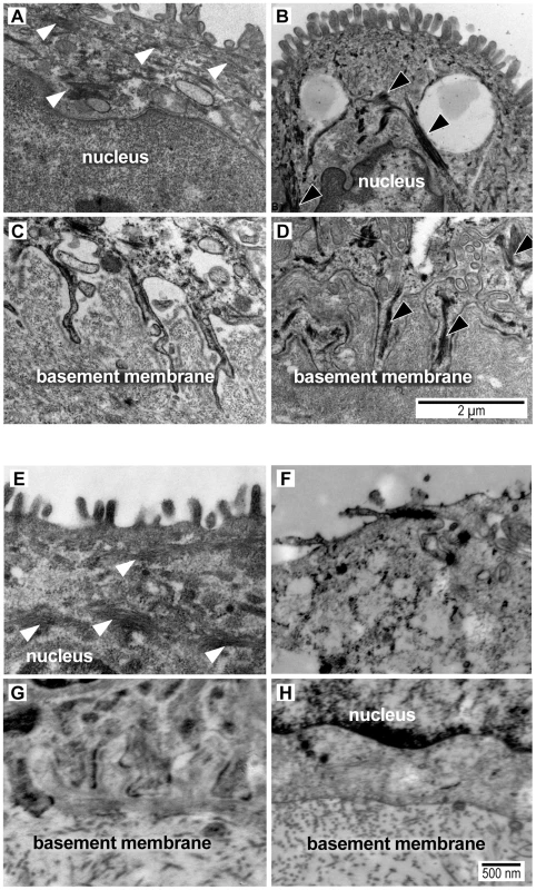 Transmission electron micrograph images of intermediate filaments (white arrowheads) in the cytoplasm and amnion foot processes from a macaque saline control (A,C) and macaque GBS sample (B,D) and from a woman at term undergoing cesarean section prior to labor (E,G) and another woman after PPROM/preterm birth (F,H).