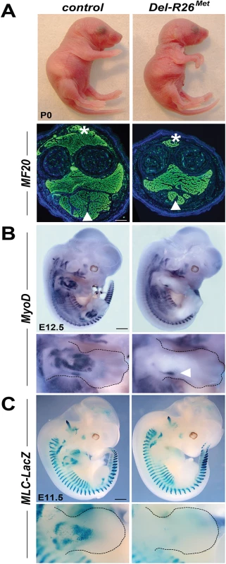 Ubiquitously excess wild-type Met in developing embryos results into hyperflexed forelimbs.
