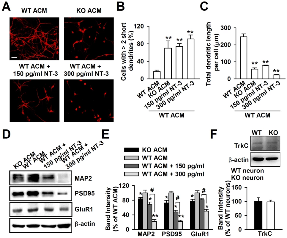 Excessive NT-3 was neurotoxic to neuronal development.