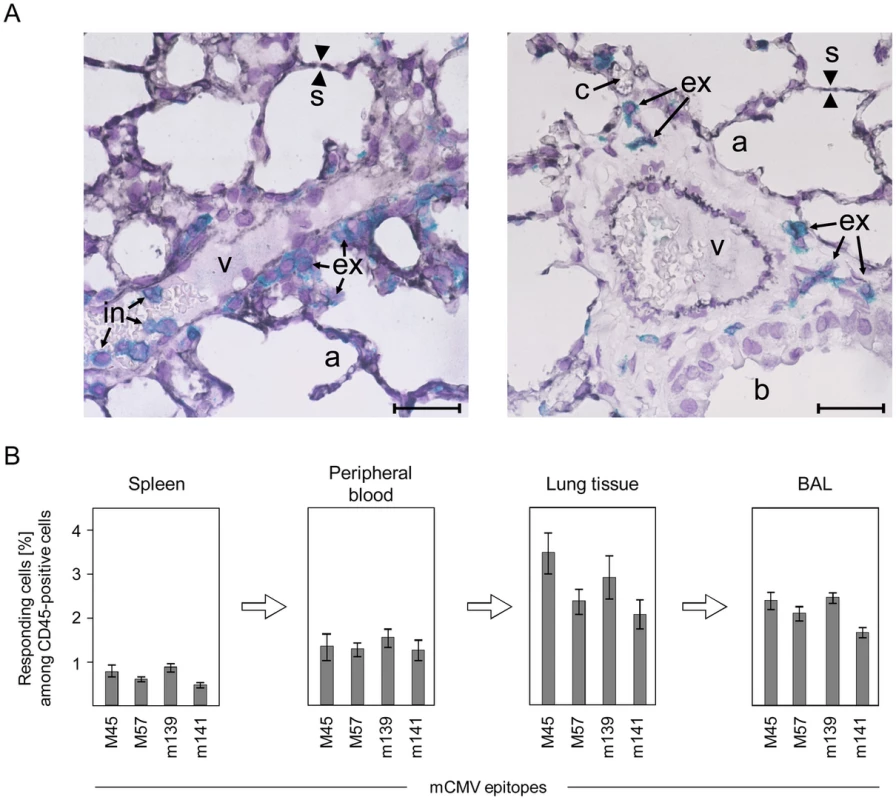 Activated virus epitope-specific CD8 T cells transmigrate from the vascular compartment into lung interstitium and alveolar epithelium.