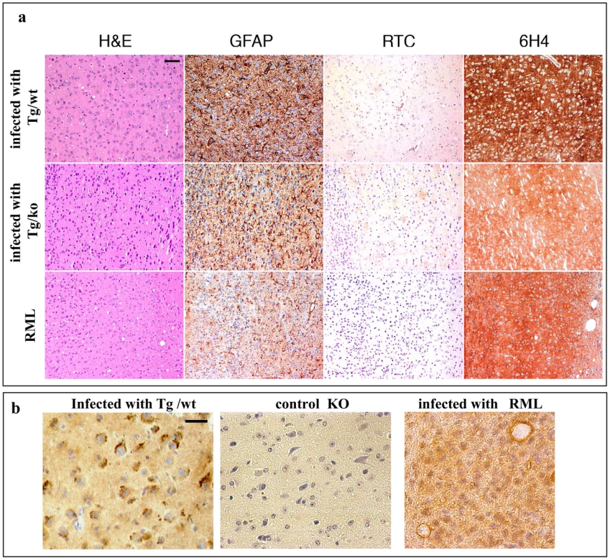Transmission of TgMHu2ME199K prions to wt mice: pathology.