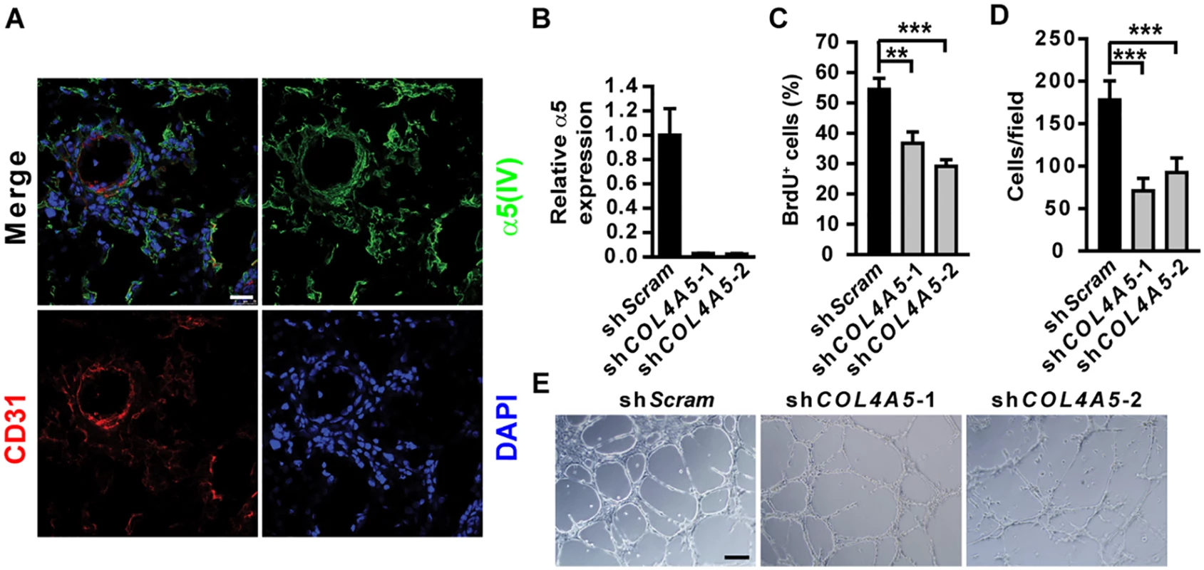 α5(IV) is expressed in endothelial cells and required for endothelial cell proliferation and tubulogenesis.