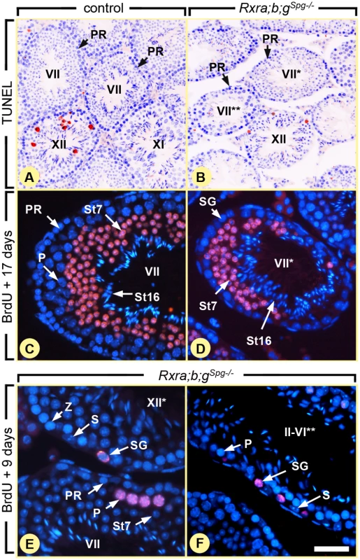 Ablation of RXR in spermatogonia blocks their division, but does not affect meiosis.