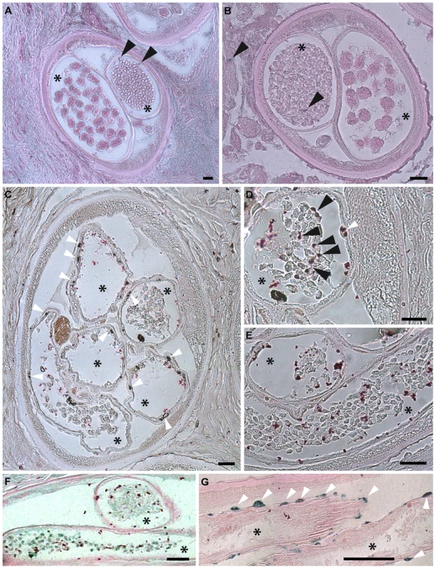 Apoptosis and apoptotic bodies are detected in <i>O. volvulus</i> tissues from human nodules of doxycycline treated patients.