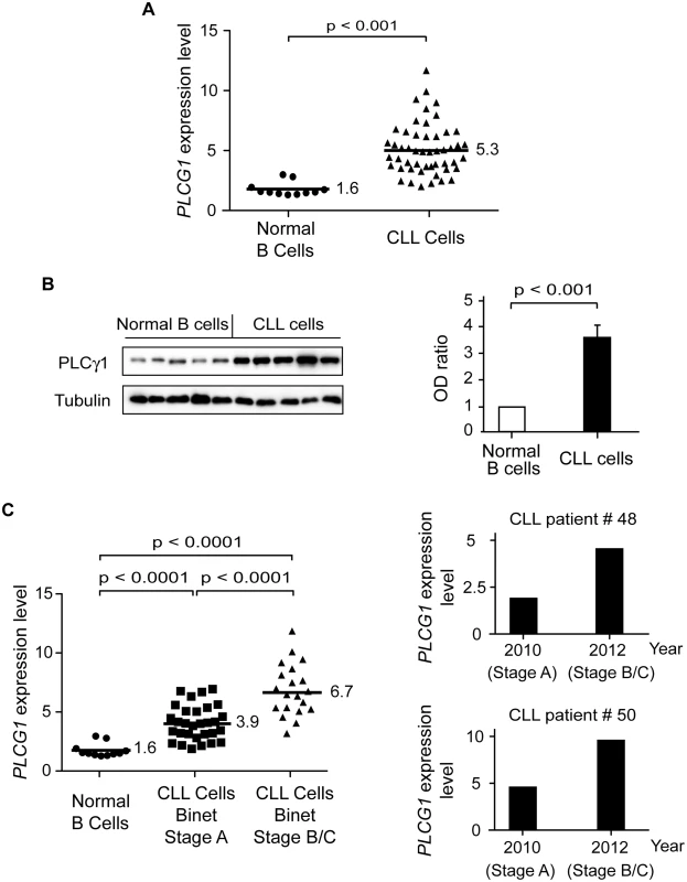 PLCγ1 is over-expressed in CLL cells.