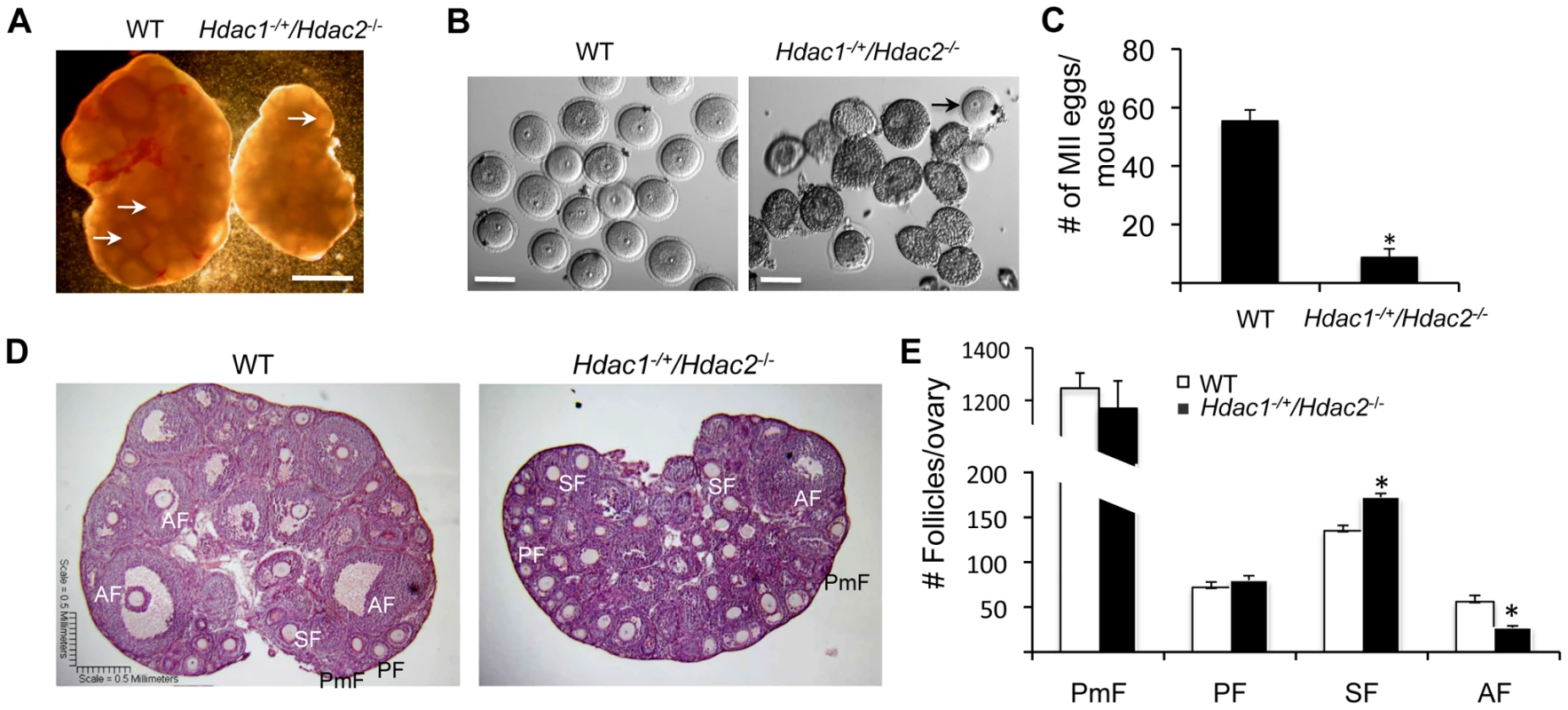 Decreased ovary size and defective oogenesis following specific targeting of <i>Hdac2</i> and reduction of <i>Hdac1</i> in oocytes.