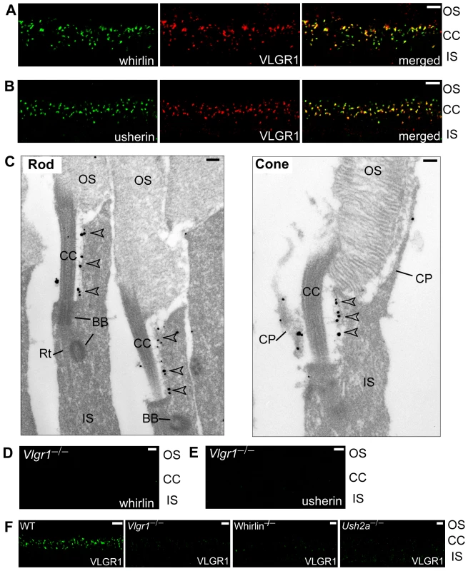 VLGR1 is colocalized with the complex of whirlin and usherin at the PMC in photoreceptors.