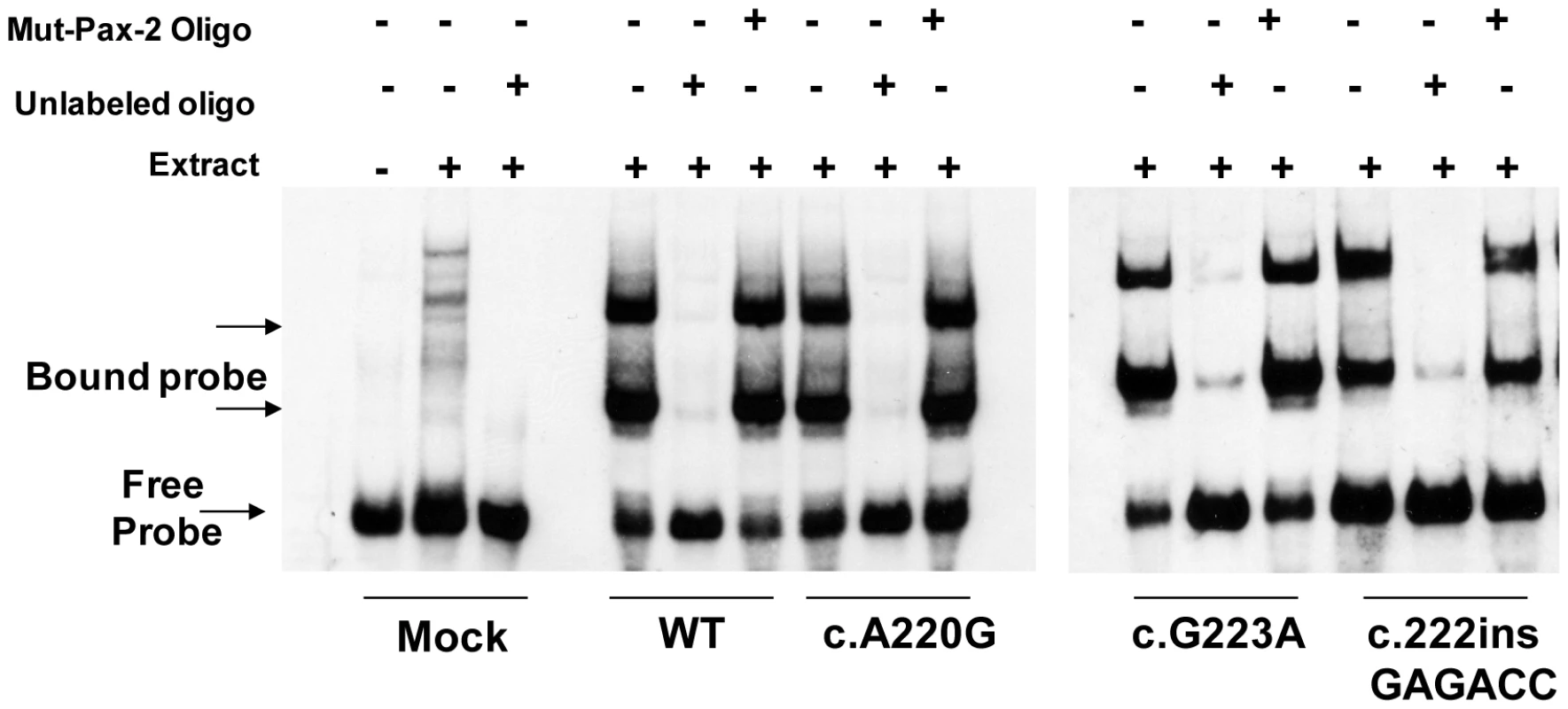 Electrophoretic mobility shift assay comparing DNA binding of wild-type and three mutant Pax2 proteins.