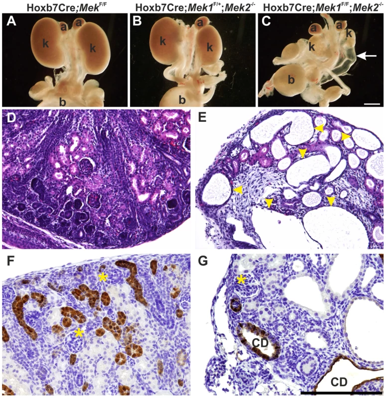 Genetic ablation of MAPK pathway specifically in ureteric bud epithelium results in severe renal hypodysplasia.