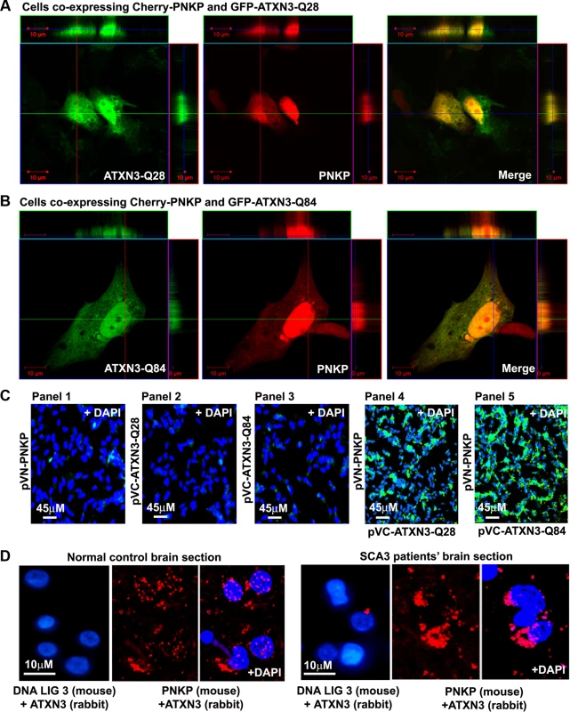 PNKP interacts with both wild-type and mutant ATXN3 in cells and human brain sections.