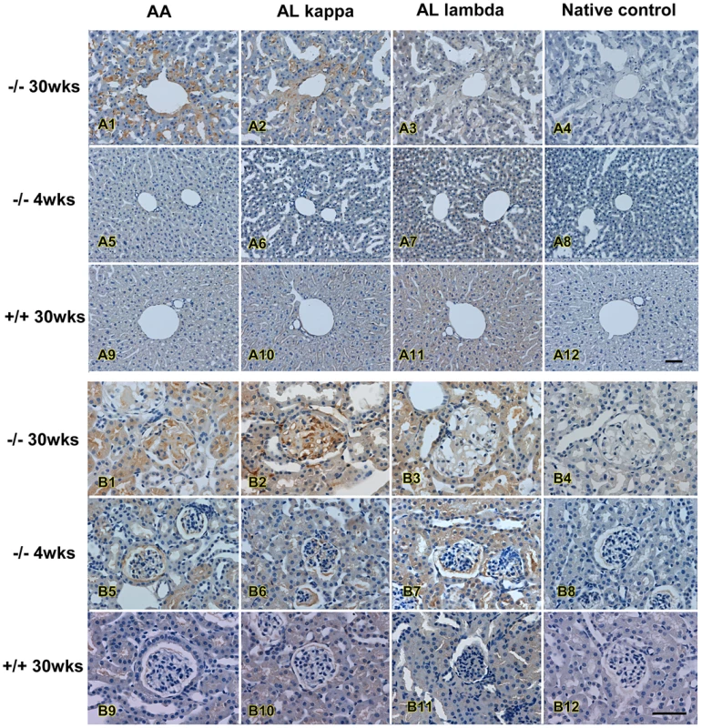Immunohistochemistry of amyloidosis in affected mice.