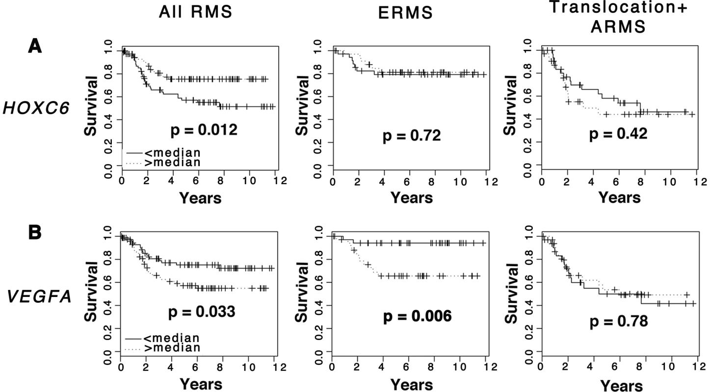 Elevated <i>VEGFA</i> expression correlates with poor clinical outcome in rhabdomyosarcoma.