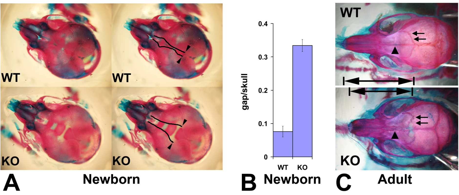 Wnt1-Ate1 mice have defects in the frontal bones.