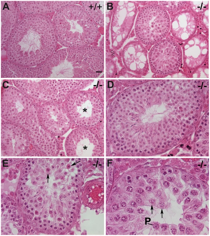 Impaired spermatogenesis in <i>Chtf18</i><sup>−/−</sup> mice.