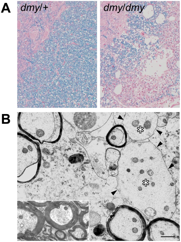 Demyelination in <i>dmy/dmy</i> rats.