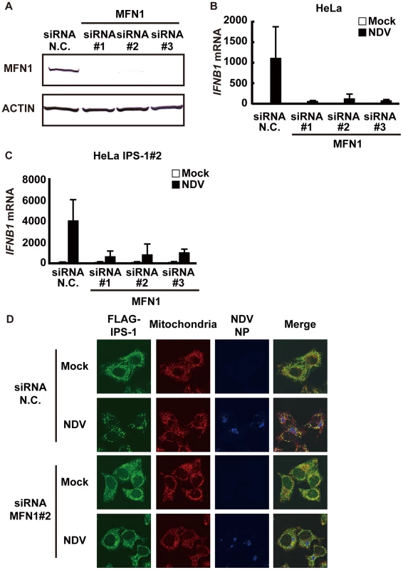 Knockdown of MFN1 inhibits the redistribution of IPS-1 induced by NDV infection.