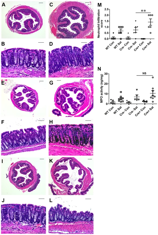 Colitis severity is more pronounced in PPARγVillinCre<sup>+</sup> mice than in wild-type mice.