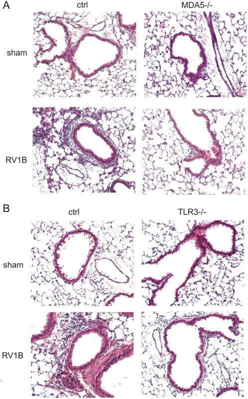 Airway inflammation in RV1B-infected MDA−/− and TLR3−/− mice.