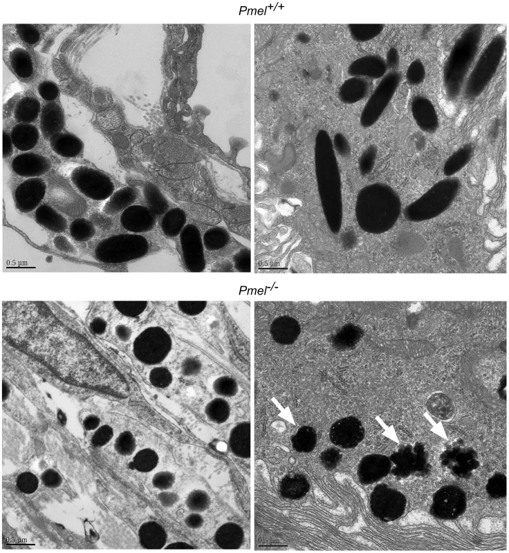 Electron microscopy of choroidal (upper and lower left micrographs) and RPE cells (upper and lower right micrographs), including melanosomes, from wild-type C57BL/6 mice (upper two micrographs) and <i>Pmel<sup>−/−</sup></i> mice (lower two micrographs), respectively.