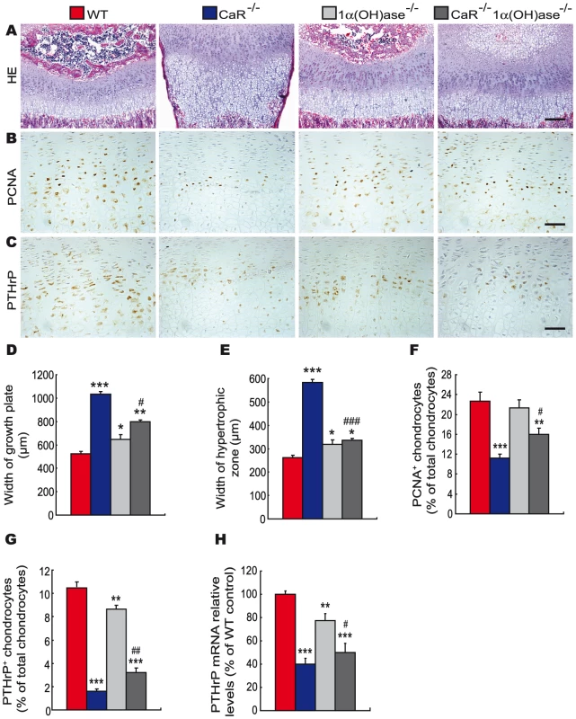Effects of deletion of 1α(OH)ase on endochondral bone formation in CaR–deficient mice.