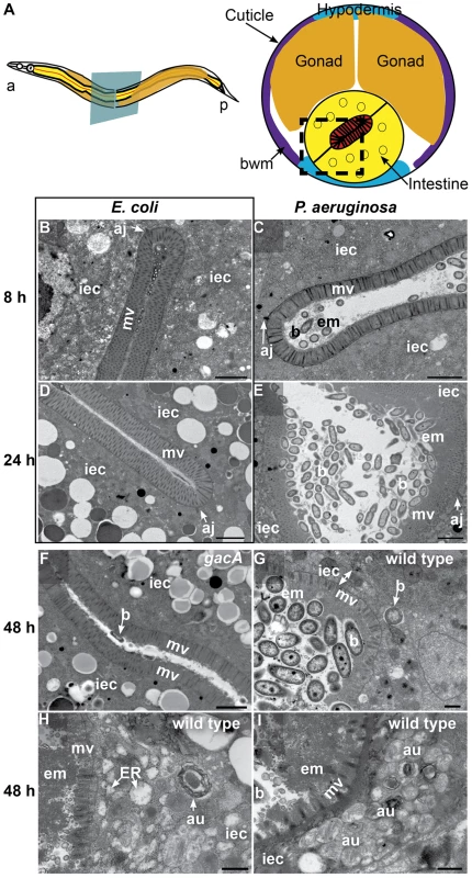 <i>P. aeruginosa</i> causes intestinal distention, extracellular material accumulation, intracellular invasion, and abnormal autophagy.