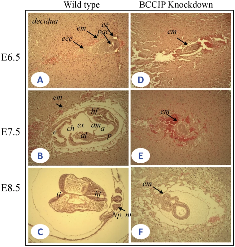Histological sections of wild-type and BCCIP knockdown embryos.