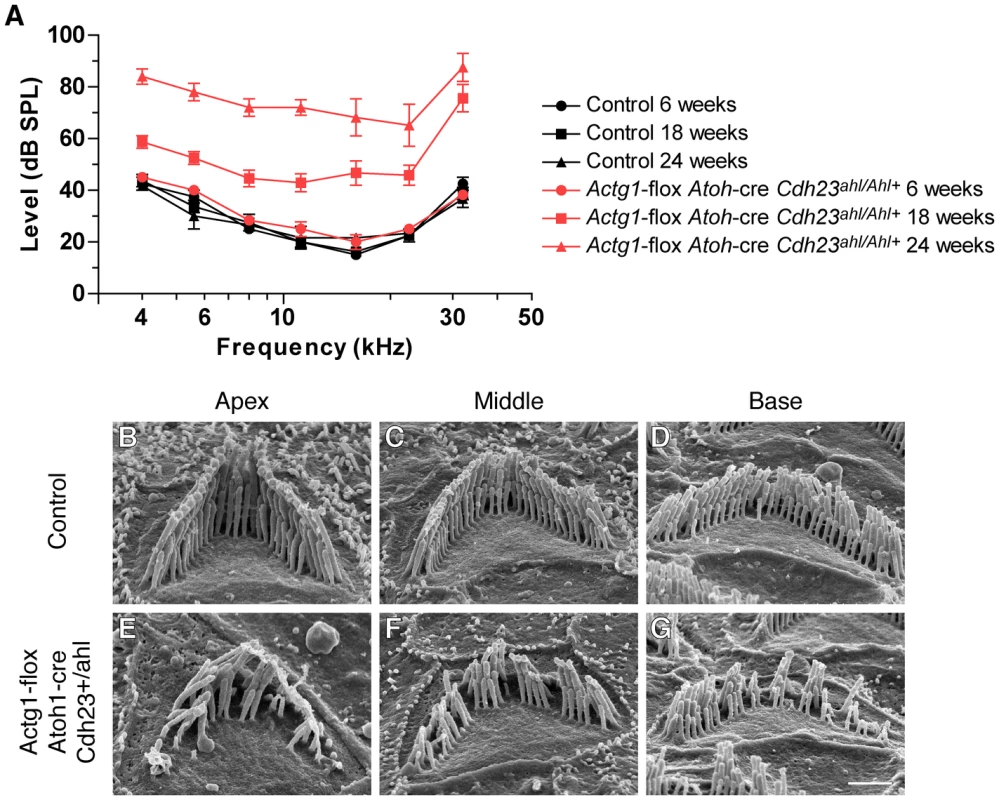<i>Cdh23<sup>Ahl+</sup></i> does not rescue progressive hearing loss in mice with γ-actin–deficient hair cells.