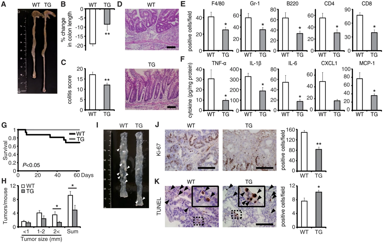 EPRAP overexpression in macrophages ameliorates DSS-induced colitis and colitis-associated tumorigenesis.