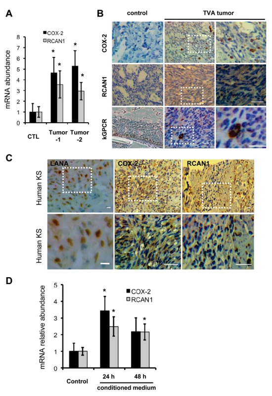 NFAT activation in mouse KS-like lesions and human KS tumors.