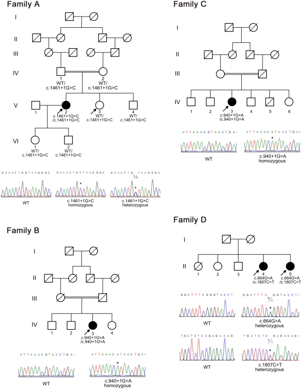 Pedigrees of the families with chronic nonspecific multiple ulcers of the small intestine.