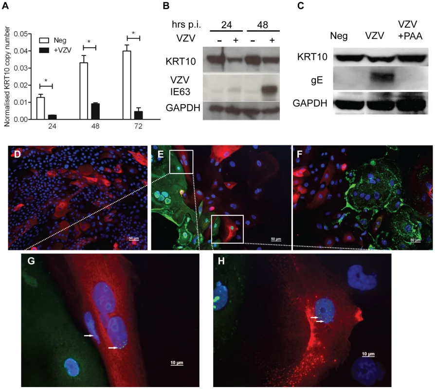 Confirming the downregulation of KRT10 by VZV in a keratinocyte cell line.