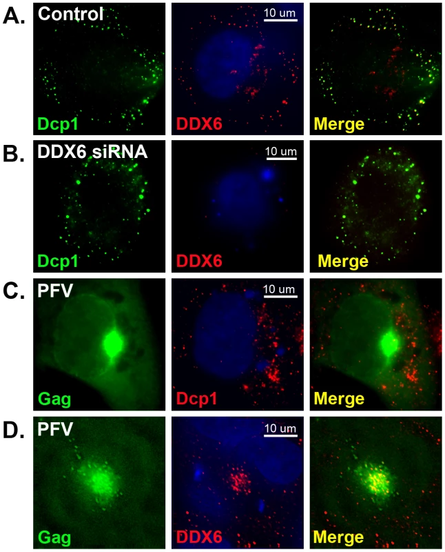 Immunofluorescent staining of DDX6 and Dcp1.