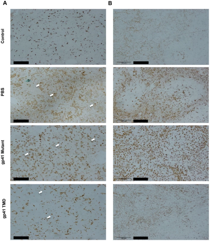 Gp41 TMD attenuates the activation of peripheral and tissue residential Macrophages in LTA/GLN treated mice.