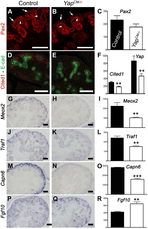 Transcriptional changes in <i>Yap</i> mutant CM progenitors cells.