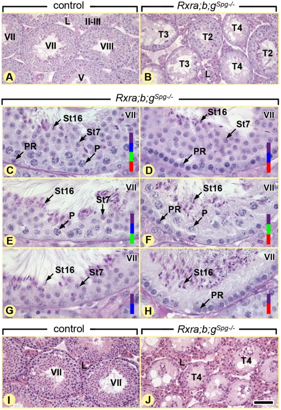 Ablation of RXR in spermatogonia induces age-related testis degeneration.
