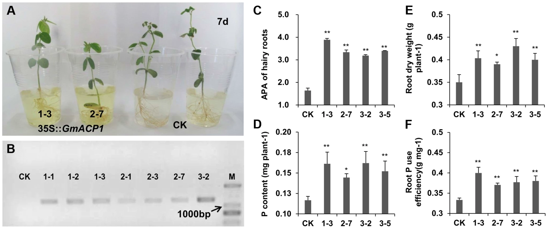 Phenotypes of hairy roots overexpressing <i>GmACP1</i> and control hairy roots (CK) cultured by hydroponics and supplied with 0.5 mM phytate.