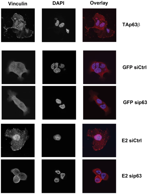 TAp63β ectopic expression and E6/E7 repression by E2 induce TAp63β-mediated focal adhesion in caski cells.