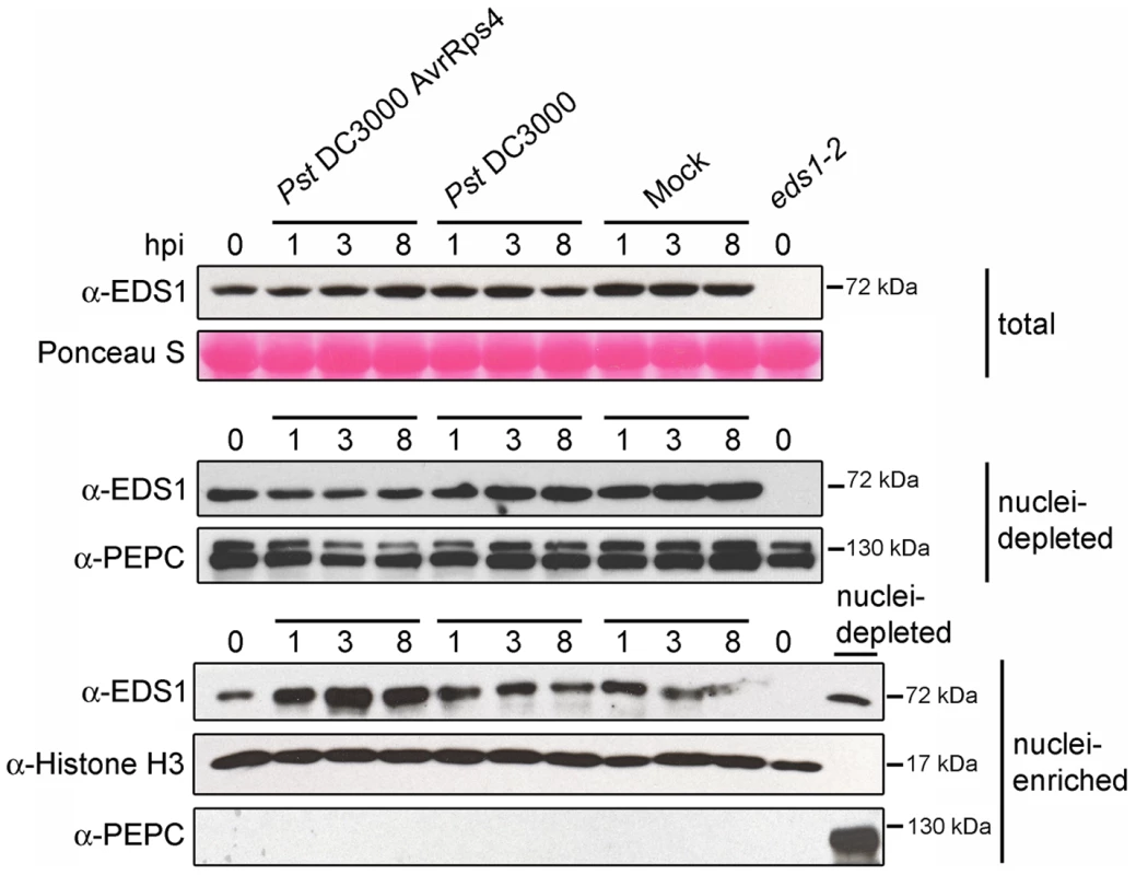 EDS1 nucleo-cytoplasmic distribution after inoculation with virulent and avirulent <i>Pst</i> DC3000 bacteria.