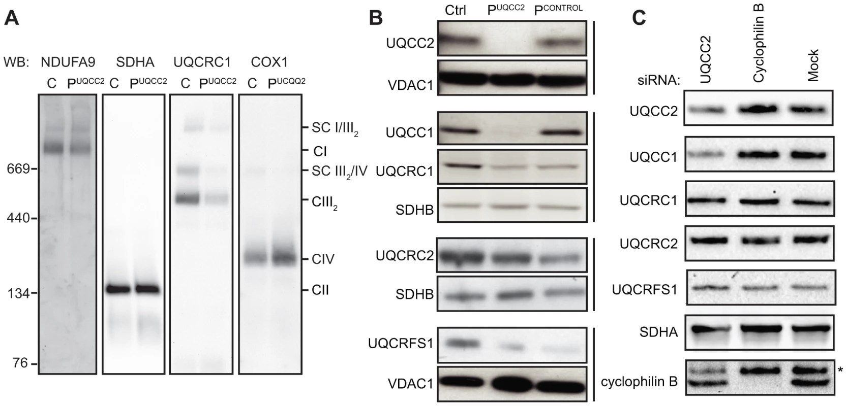 Lack of UQCC2 is associated with aberrant complex III assembly, subunit expression and UQCC1 stability.