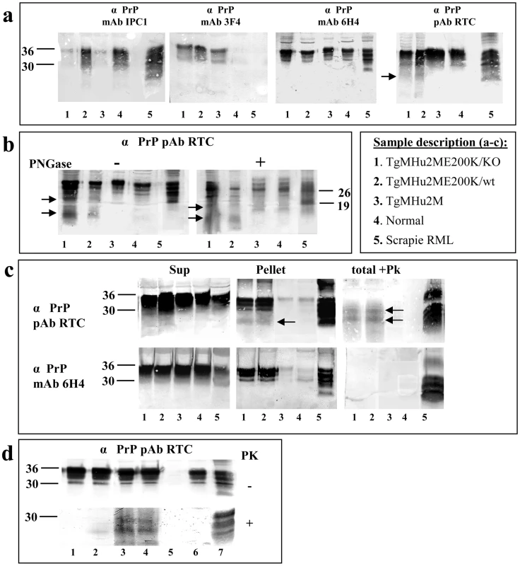 Biochemical Characterization of PrP in TgMHu2ME199K mice.