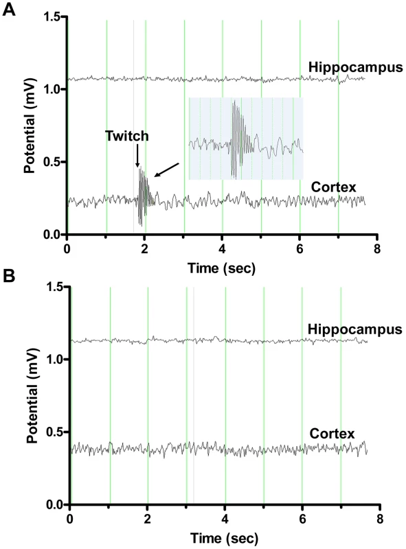 Representative electroencephalography (EEG) recordings from double deficient <i>Neu4<sup>−/−</sup>;Hexa<sup>−/−</sup></i> and single-deficient <i>Hexa</i><sup>−/−</sup> mice.