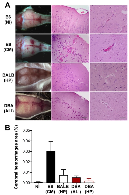 Infection of DBA/2 with <i>P. berghei</i> ANKA does not cause brain damage.