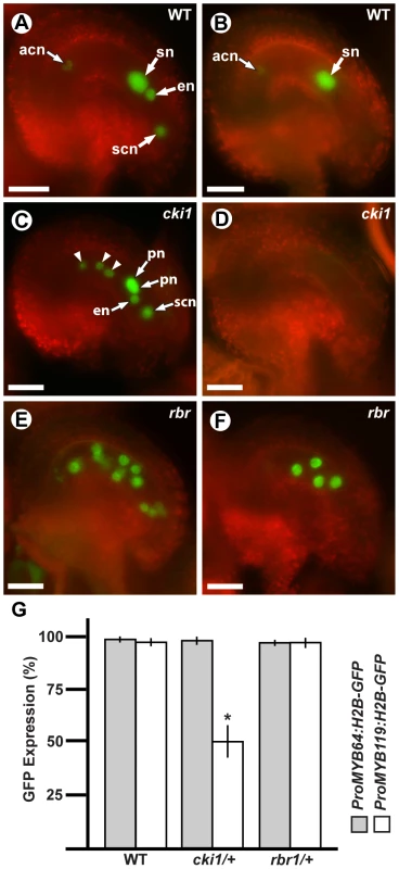 <i>MYB119</i> is downregulated in <i>cki1</i> gametophytes.