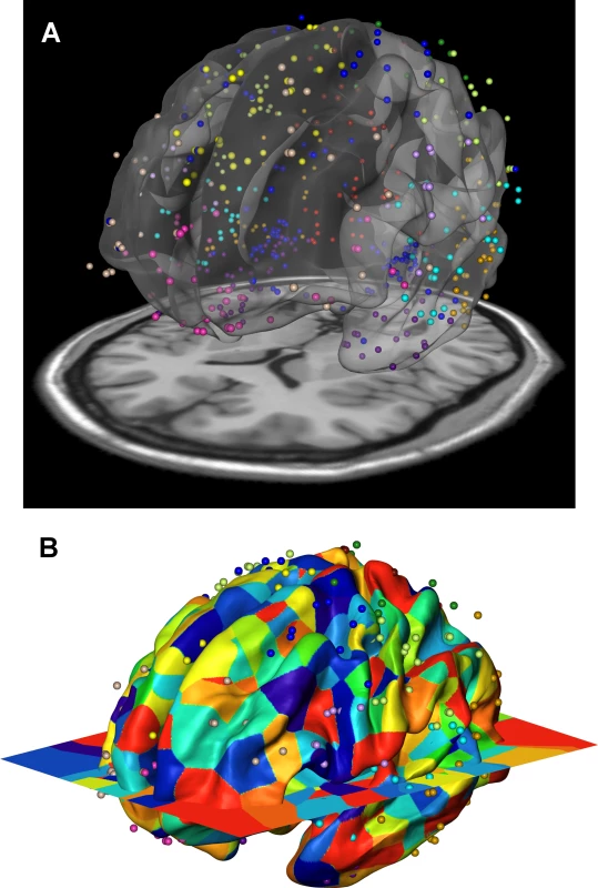 Gene expression data of the Allen Human Brain Atlas were mapped onto the 12 genetically based cortical regions in the MR space.
