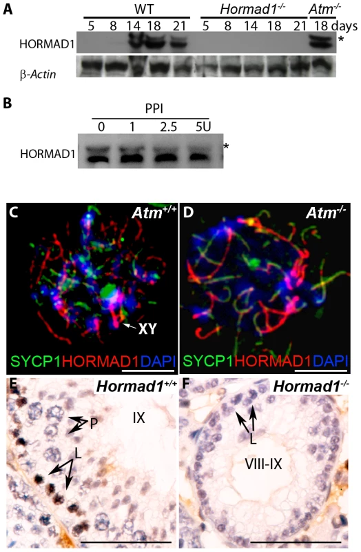 HORMAD1 phosphorylation is unaffected by <i>Atm</i> deficiency while <i>Hormad1</i> deficiency disrupts ATM autophosphorylation.