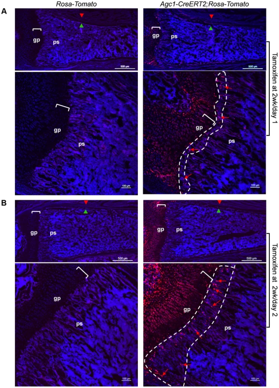 Presence in the primary spongiosa of non-chondrocytic cells derived from postnatal growth plate mature chondrocytes.