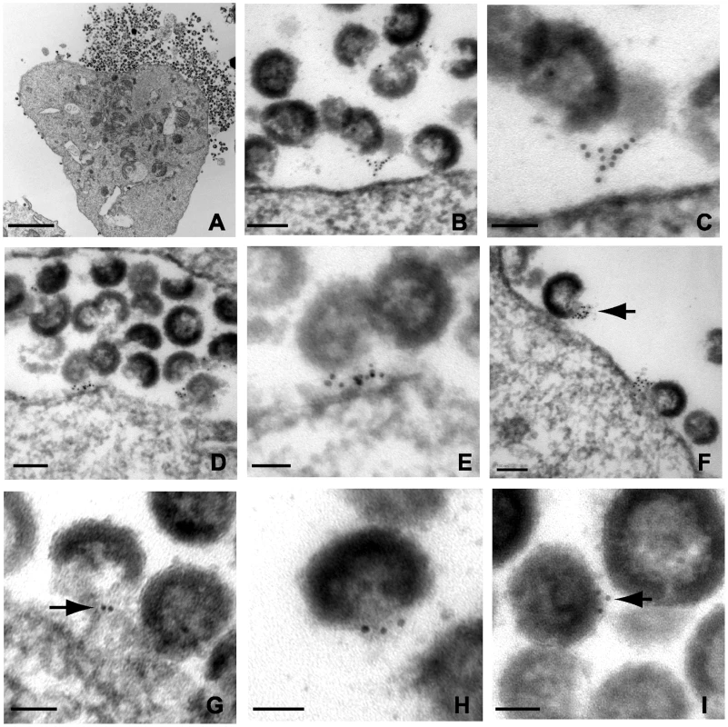 Immunoelectron micrographic analysis of tetherin of NL4.3/Udel-infected A3.01 cells treated with indinavir; labeling at site of particle budding.